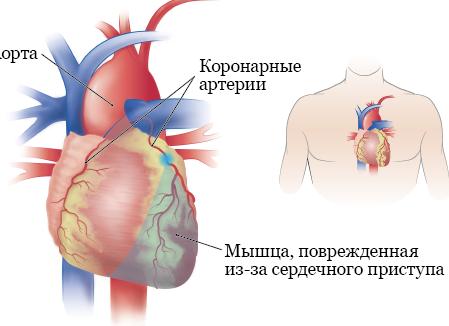 Эксперименты над собственным здоровьем: последствия применения Тригельма — Портал Консультантов 